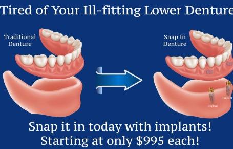 Dds dentures implants solutions